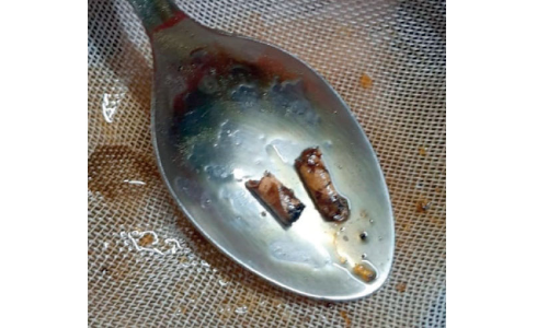 ഓണക്കിറ്റി​െല ശർക്കരയിൽ ബീഡിക്കുറ്റി