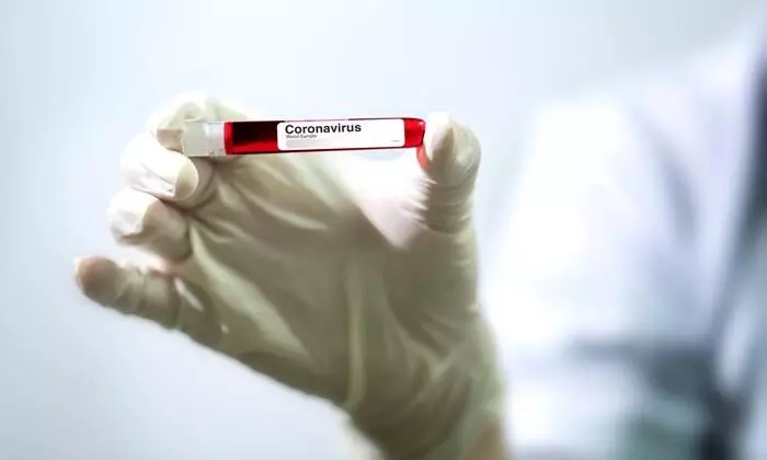 ലക്ഷണങ്ങളില്ലെങ്കിൽ േകാവിഡ് പരിശോധന ആവശ്യമില്ലെന്ന് അമേരിക്ക; അംഗീകരിക്കില്ലെന്ന് 33 സംസ്ഥാനങ്ങൾ ലക്ഷണങ്ങളില്ലെങ്കിൽ േകാവിഡ് പരിശോധന ആവശ്യമില്ലെന്ന് അമേരിക്ക; അംഗീകരിക്കില്ലെന്ന് 33 സംസ്ഥാനങ്ങൾ