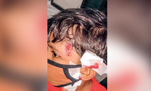 തി​രൂ​ര​ങ്ങാ​ടി​യി​ൽ തെ​രു​വു​നാ​യ് ആ​ക്ര​മ​ണം; നി​ര​വ​ധി​പേ​ർ​ക്ക് പ​രി​ക്കേ​റ്റു