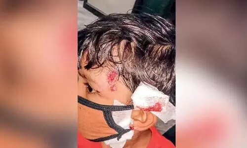 തി​രൂ​ര​ങ്ങാ​ടി​യി​ൽ തെ​രു​വു​നാ​യ് ആ​ക്ര​മ​ണം; നി​ര​വ​ധി​പേ​ർ​ക്ക് പ​രി​ക്കേ​റ്റു