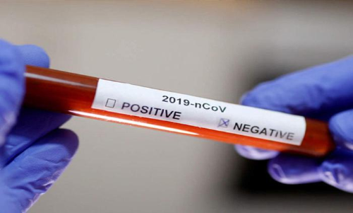 സംസ്ഥാനത്ത് ഇന്ന് 5 കോവിഡ് മരണം