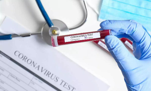 കോവിഡ് വ്യാപനത്തി​െൻറ പ്രച്ഛന്ന വഴികൾ