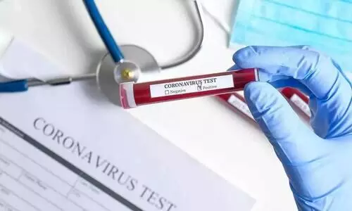 കോവിഡ് വ്യാപനത്തി​െൻറ പ്രച്ഛന്ന വഴികൾ