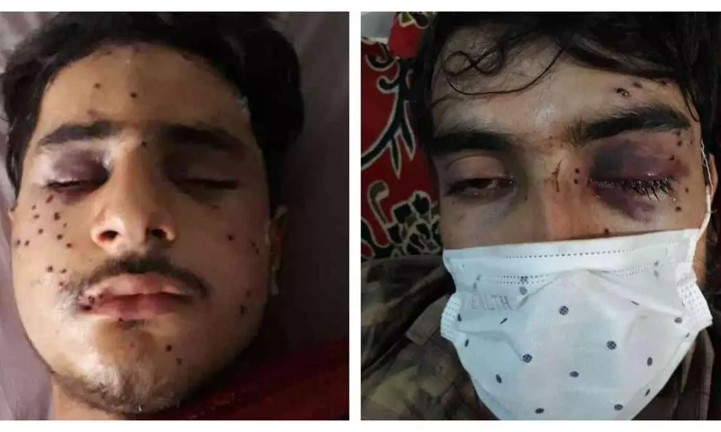 കോവിഡ്​ പ്രോ​ട്ടോകോൾ പാലിച്ചാണ്​ റാലി നീങ്ങിയത്​; പക്ഷേ എ​െൻറ കണ്ണുകൾ അവർ തകർത്തു - മുഹറം ദിനത്തിലെ പെല്ലറ്റ്​ ആക്രമണത്തിൽ കാഴ്​ച നഷ്​ടപെട്ട കശ്​മീർ യുവാവ്​ സങ്കട​ത്തോടെ പറയുന്നു