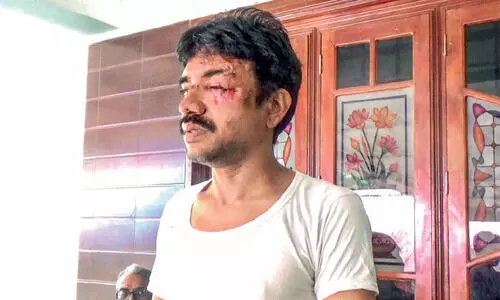 തെരുവുനായ് ആക്രമണം; ബൈക്കിൽനിന്ന് വീണ് മധ്യവയസ്കന് ഗുരുതര പരിക്ക്