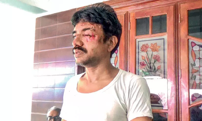 തെരുവുനായ് ആക്രമണം; ബൈക്കിൽനിന്ന് വീണ് മധ്യവയസ്കന് ഗുരുതര പരിക്ക് തെരുവുനായ് ആക്രമണം; ബൈക്കിൽനിന്ന് വീണ് മധ്യവയസ്കന് ഗുരുതര പരിക്ക്