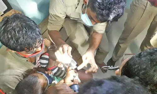 ഇഡലിത്തട്ട്​ കൈവിരലിൽ കുടുങ്ങി: രണ്ടര വയസ്സുകാരിക്ക്​ രക്ഷകരായി അഗ്​നിശമന സേന