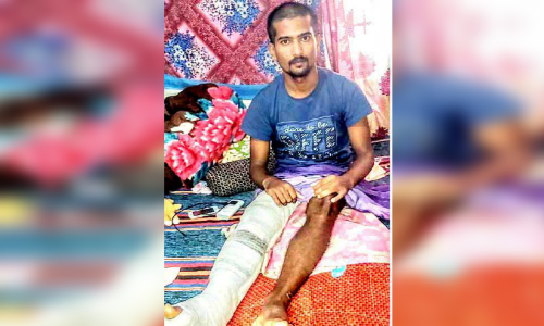 അപകടത്തിൽ കാൽ പൊട്ടി, കൂടെ കോവിഡും; എങ്കിലും​ ത​ല​ശ്ശേ​രിയുടെ സ്​നേഹത്തിൽ മനംനിറഞ്ഞ്​ സാഗർ