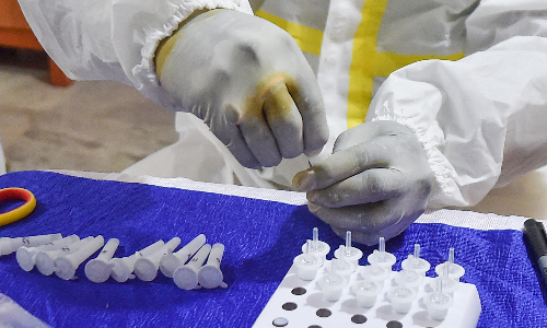 കോവിഡ്​: സൗദി അറേബ്യയിൽ മരണസംഖ്യ നാലായിരം കടന്നു