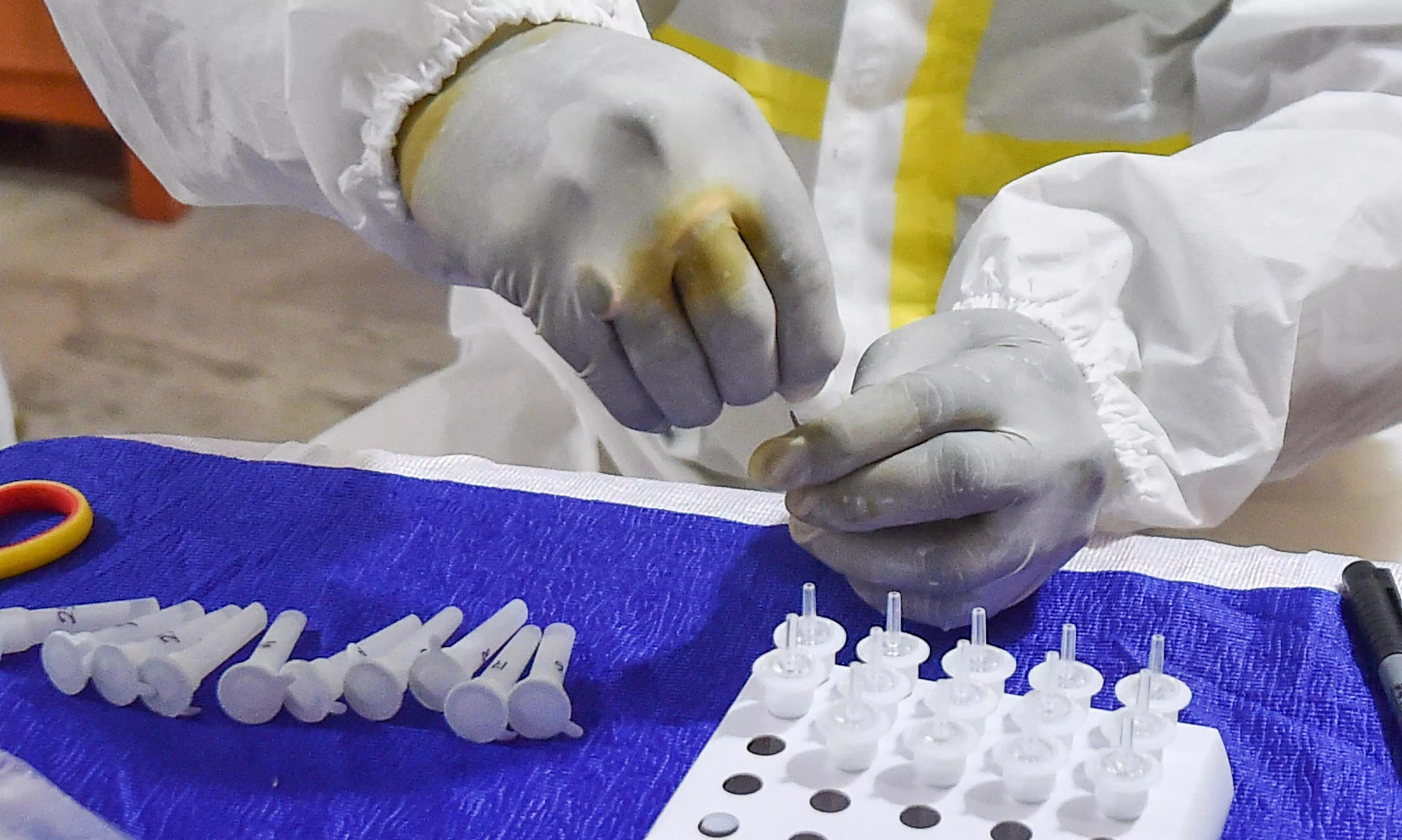 കോവിഡ്: സൗദി അറേബ്യയിൽ മരണസംഖ്യ നാലായിരം കടന്നു കോവിഡ്: സൗദി അറേബ്യയിൽ മരണസംഖ്യ നാലായിരം കടന്നു