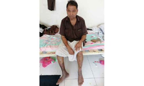 നാട്​ കണ്ടിട്ട്​ 10 വർഷം: കടവും രോഗവുമായി കുഞ്ഞീദു ദുരിതക്കയത്തിൽ