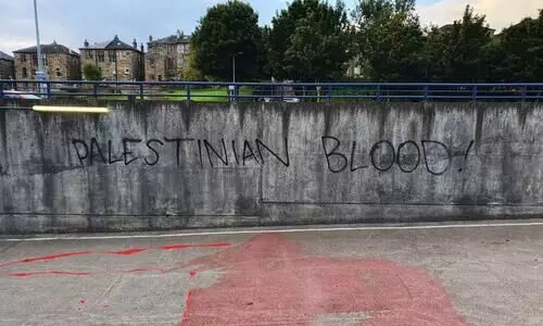 ഇത് ഫലസ്തീനിലെ ചോര; ഇസ്രായേൽ ഫുട്ബാൾ ടീമിനെതിരെ ചോരയൊഴുക്കി പ്രതിഷേധം ഇത് ഫലസ്തീനിലെ ചോര; ഇസ്രായേൽ ഫുട്ബാൾ ടീമിനെതിരെ ചോരയൊഴുക്കി പ്രതിഷേധം