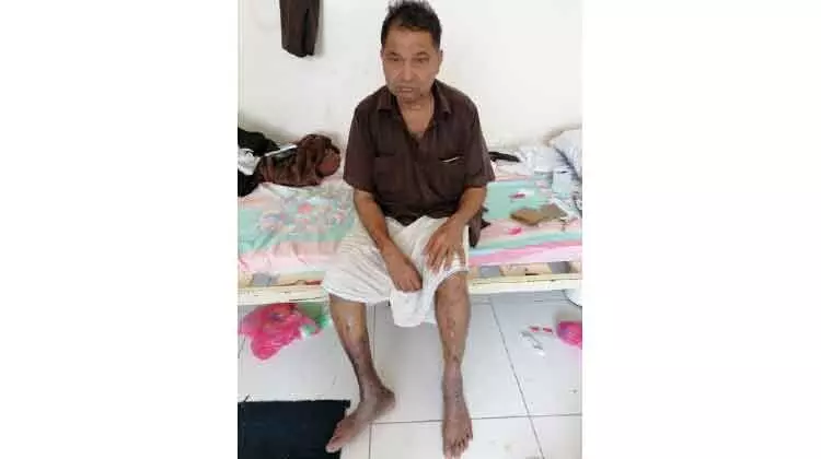 നാട് കണ്ടിട്ട് 10 വർഷം: കടവും രോഗവുമായി കുഞ്ഞീദു ദുരിതക്കയത്തിൽ നാട് കണ്ടിട്ട് 10 വർഷം: കടവും രോഗവുമായി കുഞ്ഞീദു ദുരിതക്കയത്തിൽ