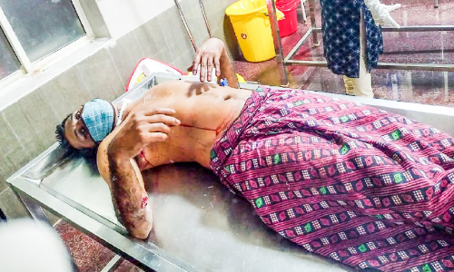 കാട്ടുപന്നി ആക്രമണം; യുവാവിന് ഗുരുതര പരിക്ക് കാട്ടുപന്നി ആക്രമണം; യുവാവിന് ഗുരുതര പരിക്ക്