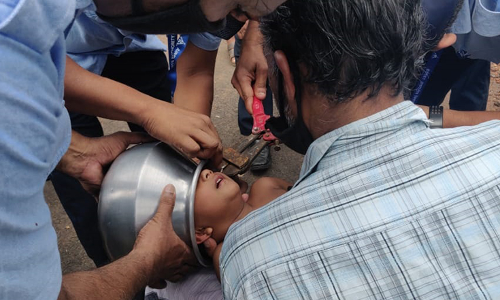 മൂന്ന് വയസ്സുകാരന്റെ തലയിൽ കലം കുടുങ്ങി; രക്ഷകരായി എയർപോർട്ട് ഫയർഫോഴ്സ് മൂന്ന് വയസ്സുകാരന്റെ തലയിൽ കലം കുടുങ്ങി; രക്ഷകരായി എയർപോർട്ട് ഫയർഫോഴ്സ്