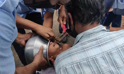 മൂന്ന് വയസ്സുകാരന്റെ തലയിൽ കലം കുടുങ്ങി; രക്ഷകരായി എയർപോർട്ട് ഫയർഫോഴ്സ് മൂന്ന് വയസ്സുകാരന്റെ തലയിൽ കലം കുടുങ്ങി; രക്ഷകരായി എയർപോർട്ട് ഫയർഫോഴ്സ്