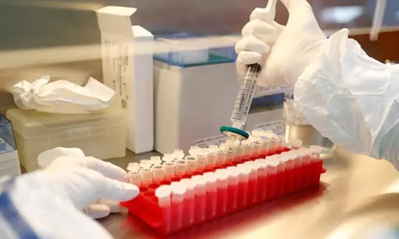 കോവിഡ് വാക്സിൻ: സെറം ഇൻസ്റ്റിറ്റ്യുട്ടിന് ഡി.സി.ജി.െഎയുടെ കാരണം കാണിക്കൽ നോട്ടീസ് കോവിഡ് വാക്സിൻ: സെറം ഇൻസ്റ്റിറ്റ്യുട്ടിന് ഡി.സി.ജി.െഎയുടെ കാരണം കാണിക്കൽ നോട്ടീസ്