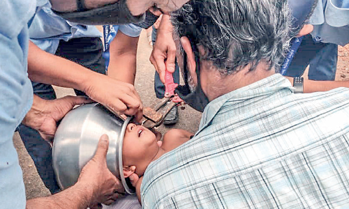 മൂന്ന്​ വയസ്സുകാര​െൻറ തലയിൽ കലം കുടുങ്ങി;  രക്ഷകരായി എയർപോർട്ട്​ ഫയർഫോഴ്​സ്​