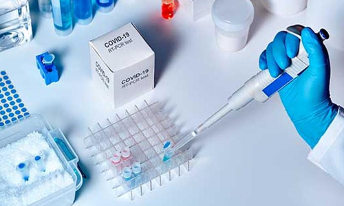 മ​രി​ച്ച​വ​രു​ടെ സ്ര​വ​ സാ​മ്പി​ൾ വീ​ട്ടി​ൽ​വെ​ച്ച്    ശേ​ഖ​രി​ക്ക​ണ​മെ​ന്ന്​