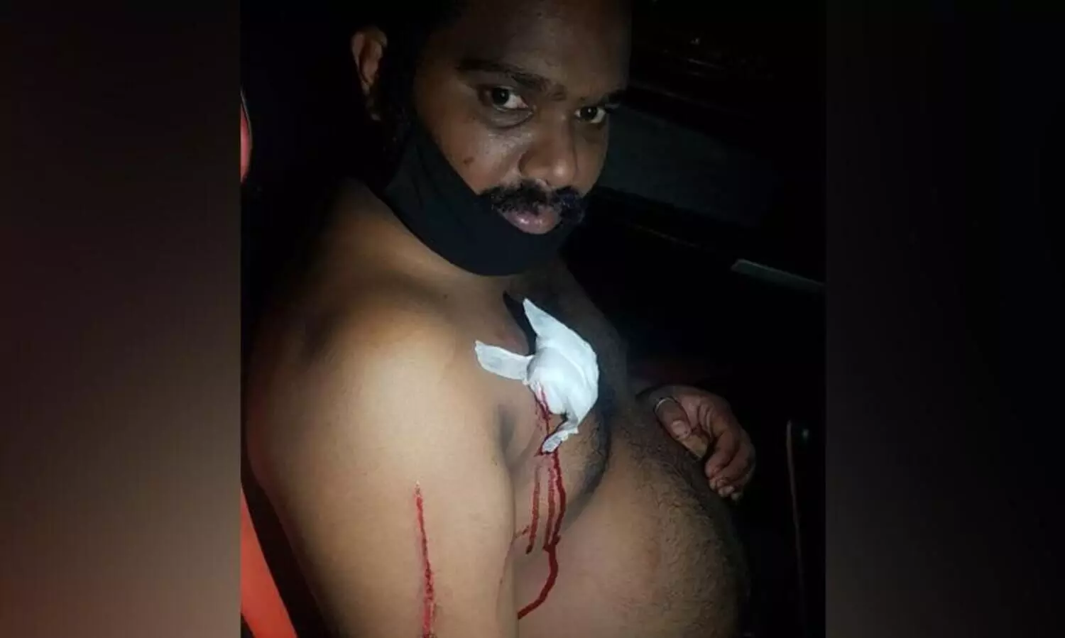 തിരുവനന്തപുരത്ത്​ ഓട്ടോ ഡ്രൈവറെ മൂന്നംഗ സംഘം വെട്ടിപരിക്കേൽപ്പിച്ചു