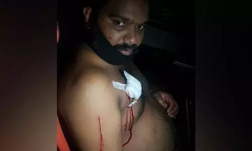 തിരുവനന്തപുരത്ത്​ ഓട്ടോ ഡ്രൈവറെ മൂന്നംഗ സംഘം വെട്ടിപരിക്കേൽപ്പിച്ചു