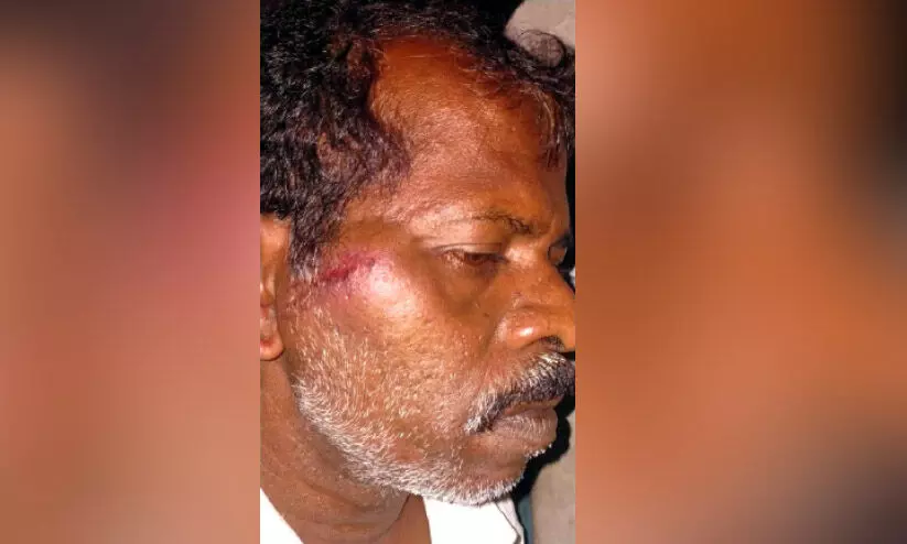 ക്ഷേത്ര ഭാരവാഹിക്ക് മയക്കുമരുന്ന് സംഘത്തിെൻറ മർദനം ക്ഷേത്ര ഭാരവാഹിക്ക് മയക്കുമരുന്ന് സംഘത്തിെൻറ മർദനം