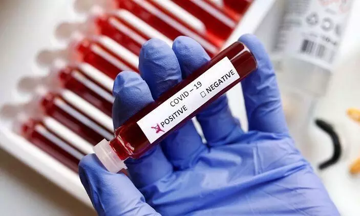 വധു ഉൾെപ്പടെ വിവാഹത്തിൽ പങ്കെടുത്ത 23 പേർക്ക് കോവിഡ് വധു ഉൾെപ്പടെ വിവാഹത്തിൽ പങ്കെടുത്ത 23 പേർക്ക് കോവിഡ്