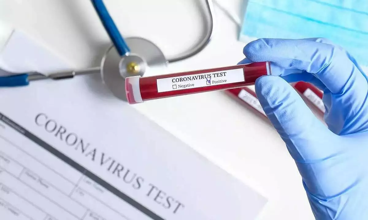 കോവിഡ്: സൗദി അറേബ്യയിൽ 1060 പേർക്ക്​ രോഗമുക്തി