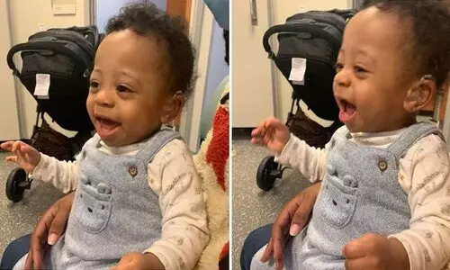 കേൾവി സഹായി തുണച്ചു; ആദ്യമായി അമ്മയുടെ ശബ്​ദം കേട്ട്​ കുഞ്ഞു മേസൺ, വൈറലായി ദൃശ്യങ്ങൾ