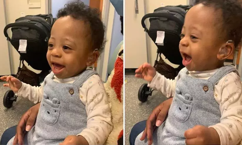 കേൾവി സഹായി തുണച്ചു; ആദ്യമായി അമ്മയുടെ ശബ്​ദം കേട്ട്​ കുഞ്ഞു മേസൺ, വൈറലായി ദൃശ്യങ്ങൾ