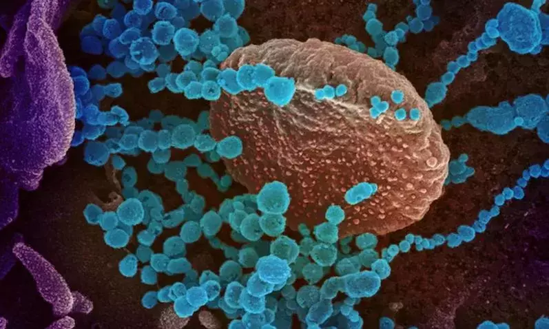 അൾട്രാവയലറ്റ്​ രശ്​മികൾ കോവിഡിനെ നശിപ്പിക്കും; മനുഷ്യന്​ ദോഷകരമാവില്ലെന്നും പഠനം