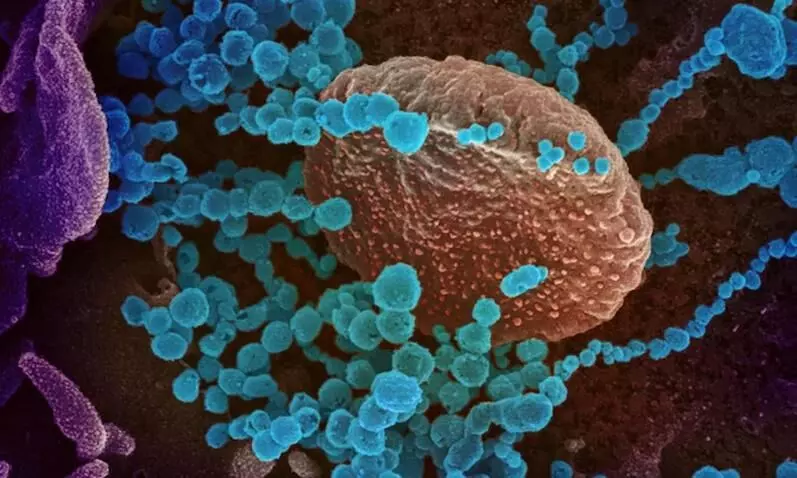 അൾട്രാവയലറ്റ്​ രശ്​മികൾ കോവിഡിനെ നശിപ്പിക്കും; മനുഷ്യന്​ ദോഷകരമാവില്ലെന്നും പഠനം