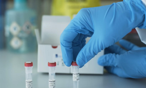 രാജ്യത്ത് 44,684 പേർക്ക് കൂടി കോവിഡ്; 520 മരണം