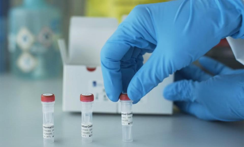 സെക്ര​േട്ടറിയറ്റിന്​ മുന്നിലെ സമരങ്ങൾ നേരിട്ട അസി. കമീഷണർക്ക്​ കോവിഡ്​; സ​മ്പ​ര്‍ക്ക​പ​ട്ടി​ക സ​ങ്കീ​ർ​ണം