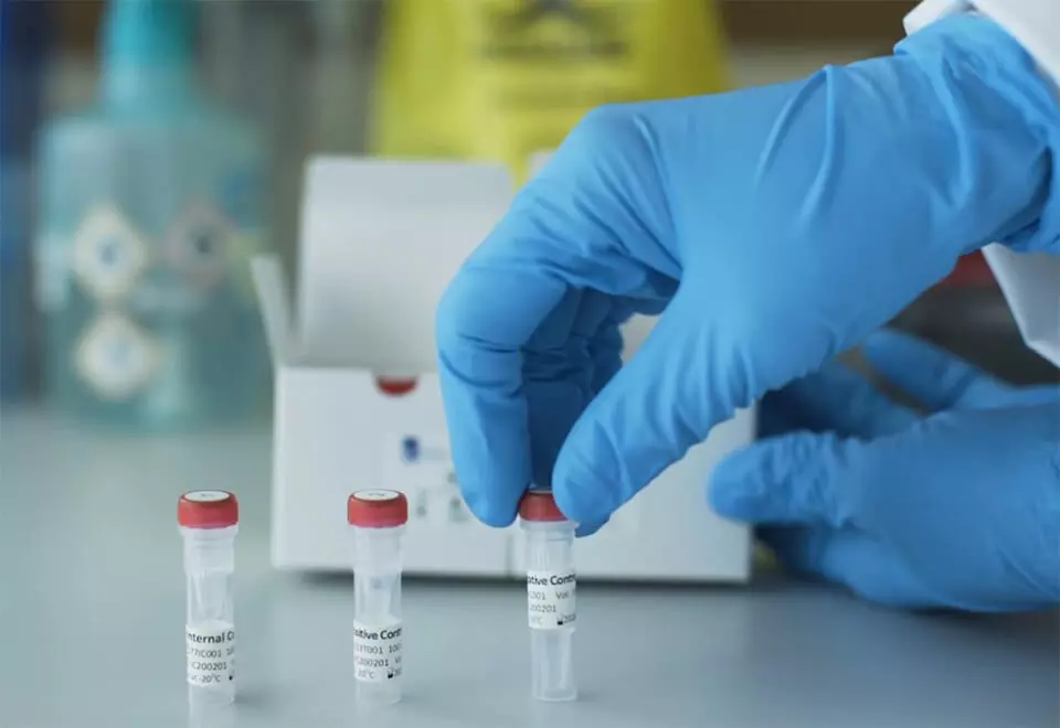 രാജ്യത്ത് 44,684 പേർക്ക് കൂടി കോവിഡ്; 520 മരണം രാജ്യത്ത് 44,684 പേർക്ക് കൂടി കോവിഡ്; 520 മരണം