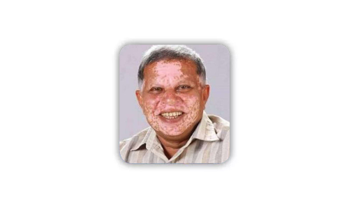 സ​ഹാ​യ​ക​മാ​യ​ത് കി​ഫ്ബി ഫ​ണ്ട് വ​ക​യി​രു​ത്തി ന​ട​ത്തി​യ വി​ക​സ​ന​പ്ര​വ​ർ​ത്ത​ന​ങ്ങ​ൾ -സി.​കെ. ശ​ശീ​ന്ദ്ര​ൻ