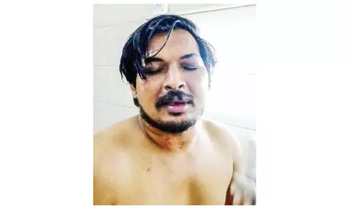 എ.ഐ.വൈ.എഫ് നേതാവിന്​ ഗുണ്ടാസംഘത്തി​െൻറ മർദനം