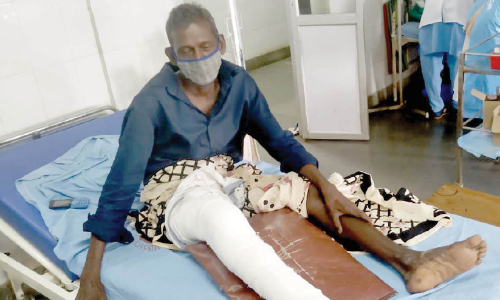 കാട്ടുപന്നിയുടെ ആക്രമണത്തിൽ പരിക്കേറ്റു