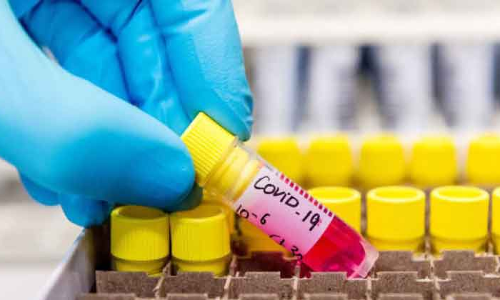 കുവൈത്തിൽ 616 പേർക്കുകൂടി കോവിഡ്​; 729 പേർക്ക്​ രോഗമുക്തി