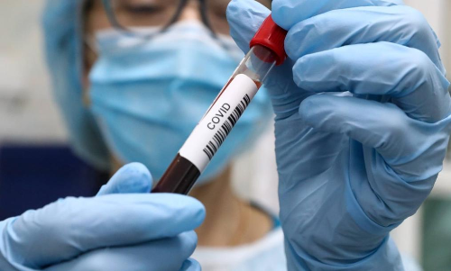 സംസ്ഥാനത്ത് ഇന്ന് കോവിഡ് സ്ഥിരീകരിച്ചത് 7006 പേര്‍ക്ക്