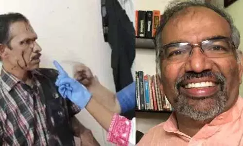 അടി കൊണ്ടത് ജെട്ടി നിരീക്ഷകന് മാത്രമല്ല, ഒളിഞ്ഞിരുന്ന് നോക്കുന്ന എല്ലാവർക്കുമാണ്