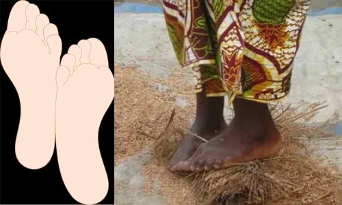 വെളുത്ത കാലുകളുടെ ഫെമിനിസവും മണ്ണിൽ ചവിട്ടി നിൽക്കുന്ന സ്​ത്രീകളും