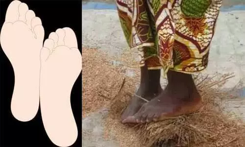 വെളുത്ത കാലുകളുടെ ഫെമിനിസവും മണ്ണിൽ ചവിട്ടി നിൽക്കുന്ന സ്​ത്രീകളും