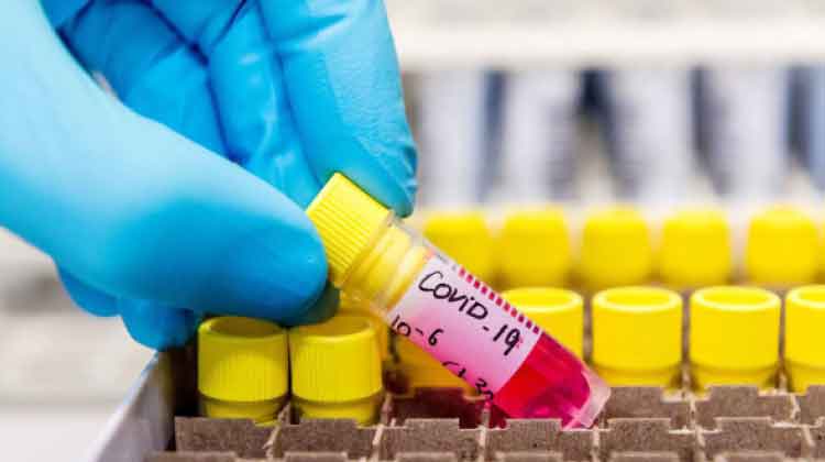 കോവിഡ്: രോഗികൾ 200, രോഗമുക്തർ 226 കോവിഡ്: രോഗികൾ 200, രോഗമുക്തർ 226