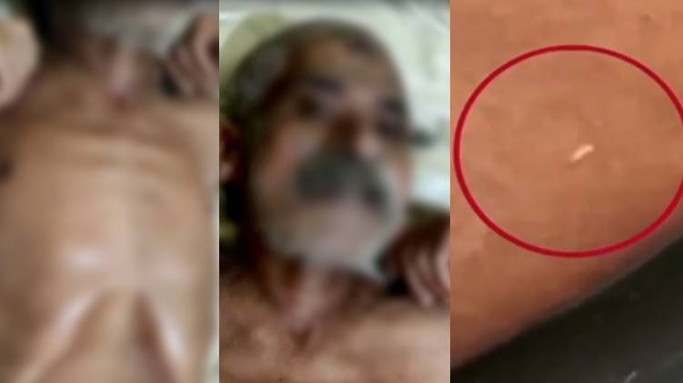 കോവിഡ് വാർഡിൽ പുഴുവരിച്ചയാളുടെ ആരോഗ്യനിലയിൽ പുരോഗതി കോവിഡ് വാർഡിൽ പുഴുവരിച്ചയാളുടെ ആരോഗ്യനിലയിൽ പുരോഗതി