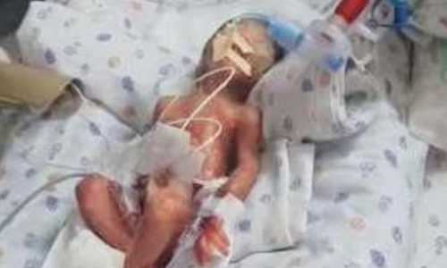 ചികിത്സ കിട്ടിയില്ല; പ്രസവ മുറിയിൽ നവജാത ശിശു മരിച്ചു