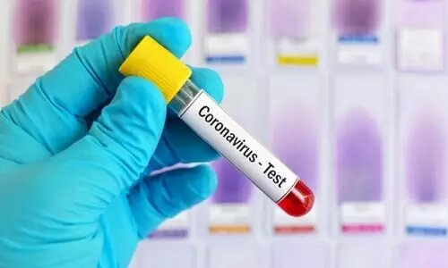 കോവിഡ് പരിശോധന: സ്വകാര്യ ലാബുകളിൽ വൻ ക്രമക്കേടെന്ന് കോവിഡ് പരിശോധന: സ്വകാര്യ ലാബുകളിൽ വൻ ക്രമക്കേടെന്ന്