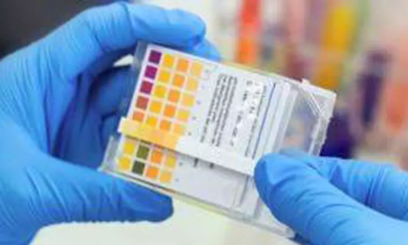 കോവിഡ് പരിശോധനയ്ക്ക് ഇന്ത്യയുടെ പേപ്പര്‍ സ്ട്രിപ് കിറ്റ്; ഉറ്റുനോക്കി ലോകം