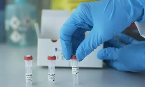 മേഘാലയയിൽ ഈ മാസം 16 മുതൽ സൗജന്യ കോവിഡ്​ പരിശോധനയില്ല