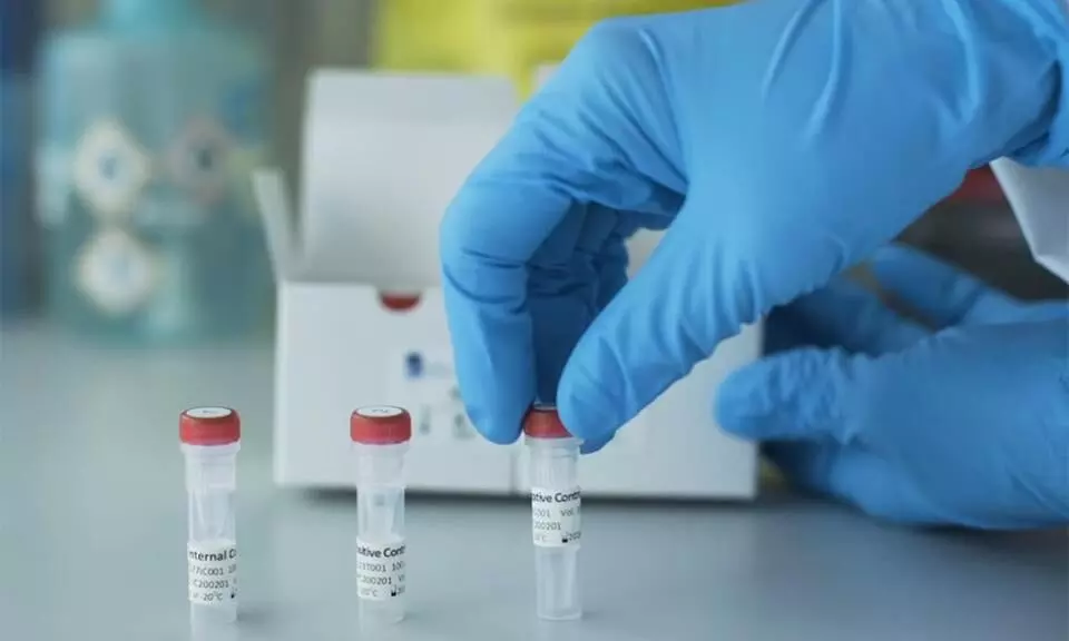 മേഘാലയയിൽ ഈ മാസം 16 മുതൽ സൗജന്യ കോവിഡ്​ പരിശോധനയില്ല